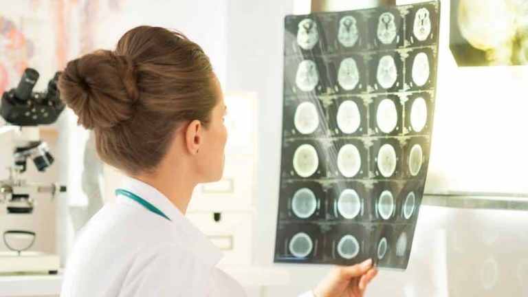 doenças que o Neurologista trata