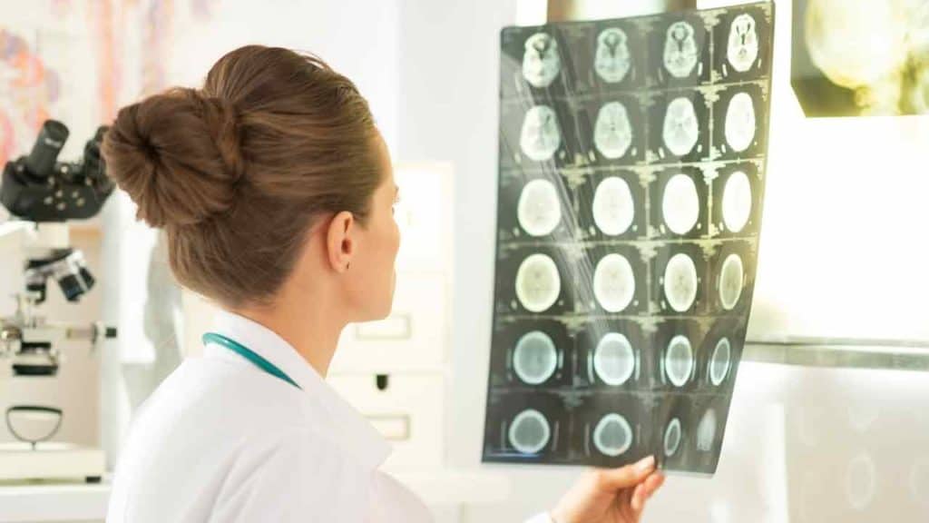 doenças que o Neurologista trata